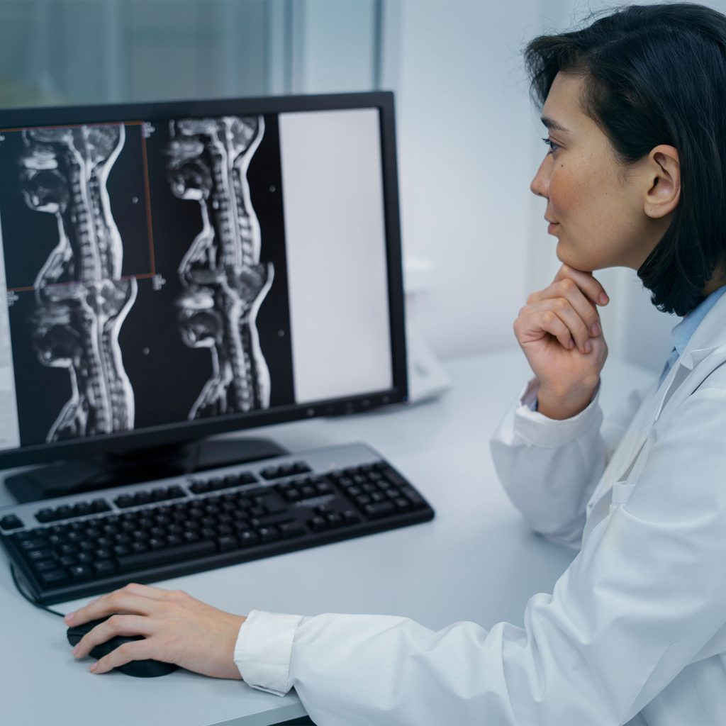Fotografía de Rayos X en computadora